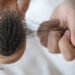 Stopping Hair Loss and Selling Hair Development