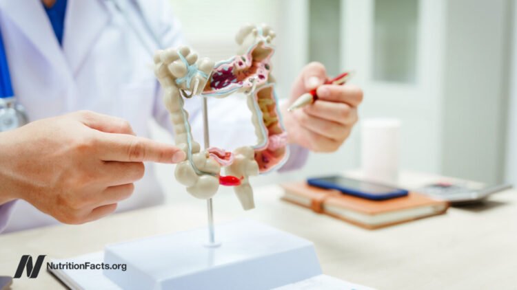 The Validity of SIBO Assessments 