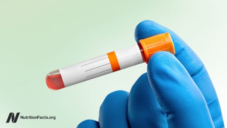 Splendid vs. Regular Ldl cholesterol Ranges 