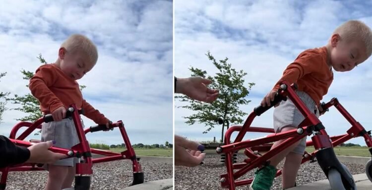 2-year-old with Schwartz-Jampel syndrome defies the percentages