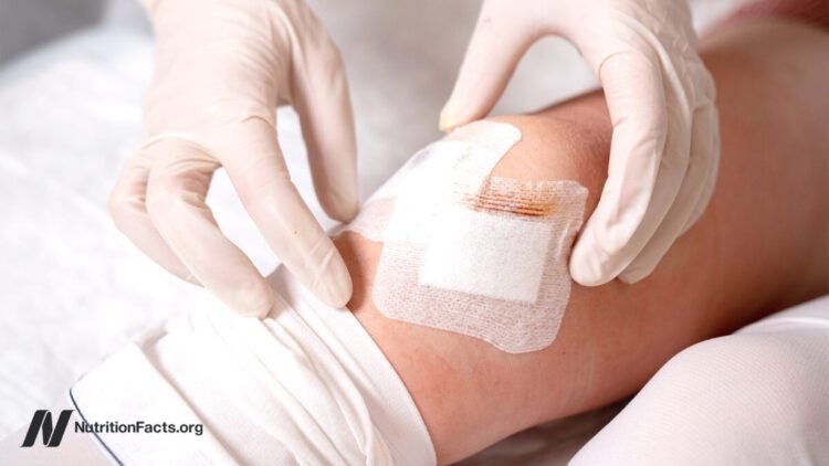 When the Repair Is an Phantasm