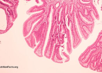 May Bovine Leukemia Virus be a Reason behind Breast Most cancers?