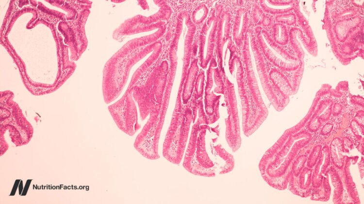 May Bovine Leukemia Virus be a Reason behind Breast Most cancers?