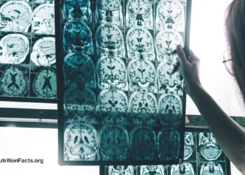 A Persistent Pesticide Is Linked to Alzheimer’s Danger