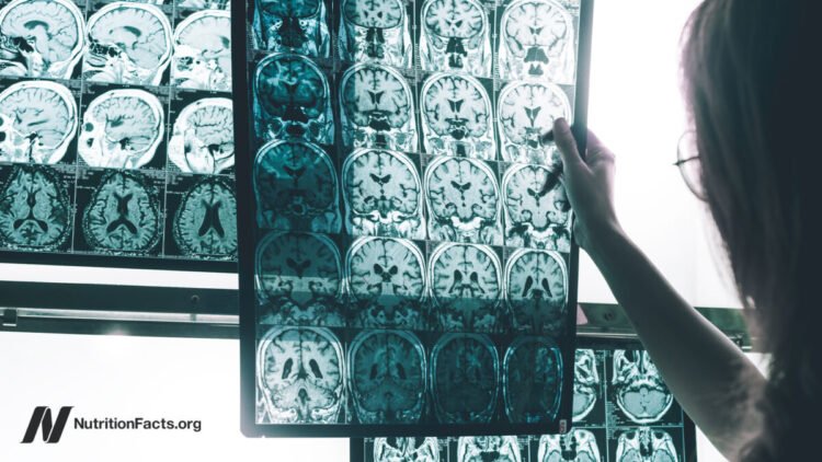 A Persistent Pesticide Is Linked to Alzheimer’s Danger