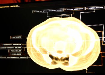 Midjourney, The AI Picture Generator, Is Growing A Full-Physique Ultrasonic Scanner