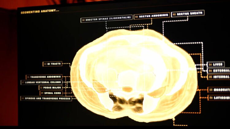 Midjourney, The AI Picture Generator, Is Growing A Full-Physique Ultrasonic Scanner