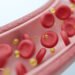 How a Single Meal Can Cripple Your Arteries and Lungs