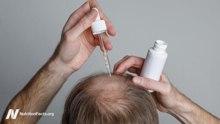 The Advantages and Dangers of Hair Loss Medicine