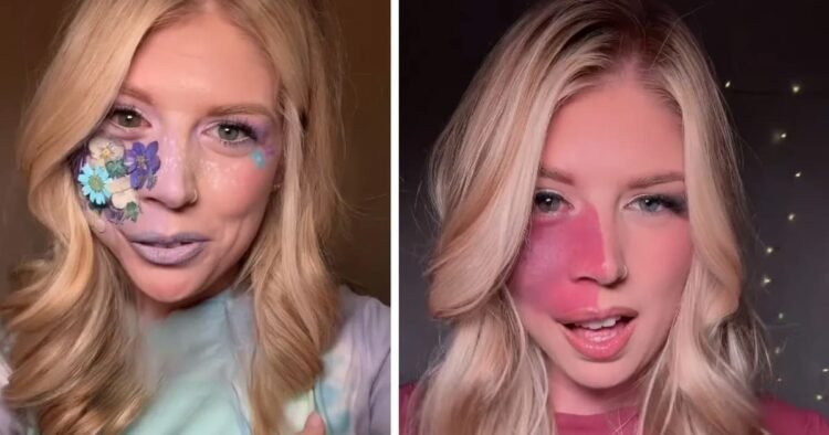 Girl With Facial Birthmark Embraces Her Look